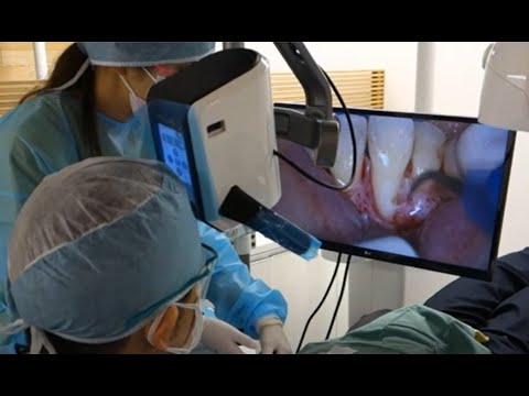 Watch the Mielscope video