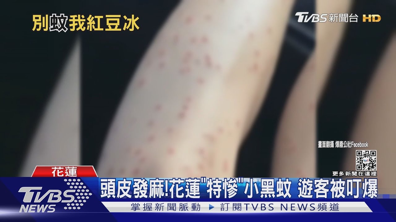 頭皮發麻!花蓮「特慘」小黑蚊 遊客被叮爆