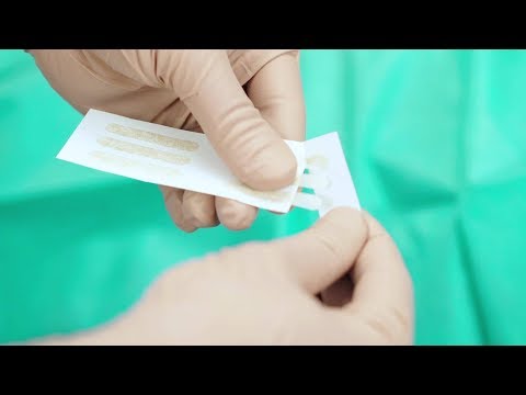 ha bekötözi a hímvesszőt a tövénél