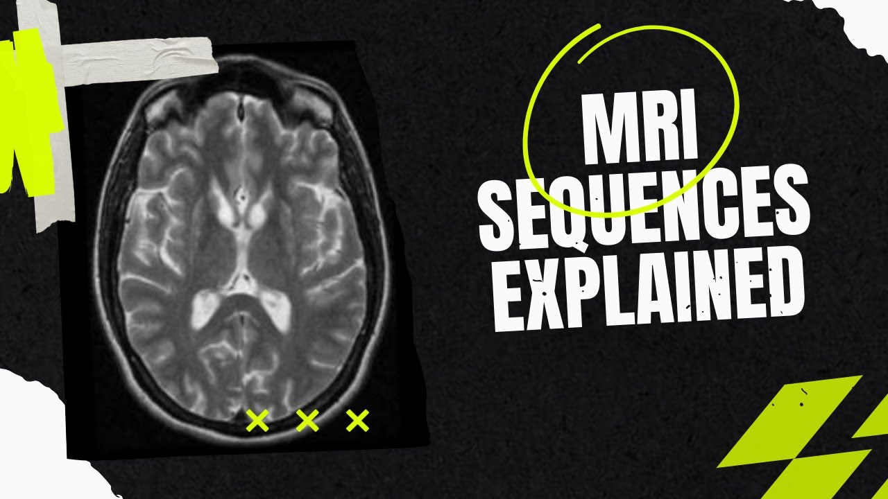 MRI sequences- How to identify , the easy way? For medical students, residents, clinicians.