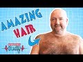 Operation Ouch The UK S Hairiest Man
