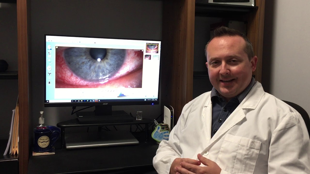 Dr. Josh Talks About Conjunctivitis (Pink Eye)