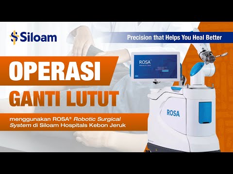 ROSA Robotic System Video 2405