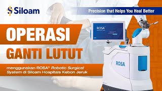 ROSA Robotic System