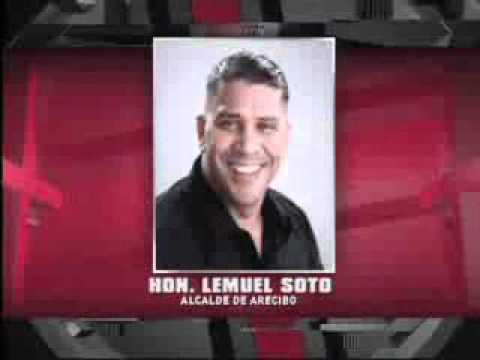 SuperXclusivo - Alcalde se somete a una cirugía estética