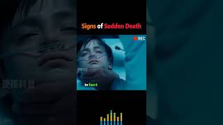 the signs of sudden death 💀#doctors