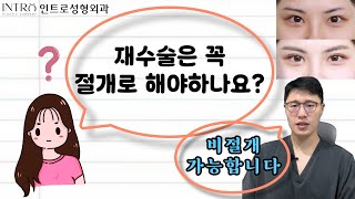 쌍꺼풀 재수술도 비절개로 가능합니다