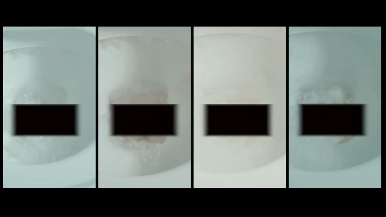 结直肠癌 - 您在厕所里应该做些什么呢?