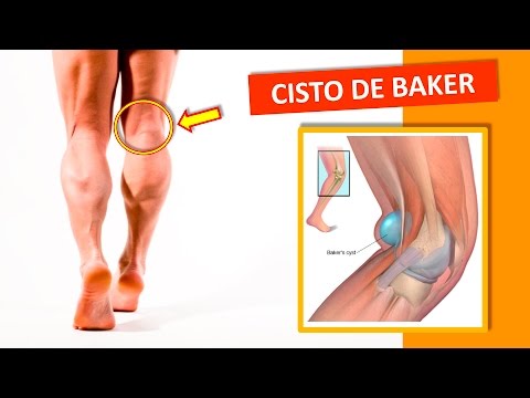 Lo fa Bishofit aiutare con dolori articolari Se il dolore dalla vita si arrende