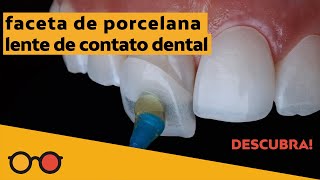 Lentes de contato dental: dói para colocar? Como é o desgaste nos dentes para faceta de porcelana?
