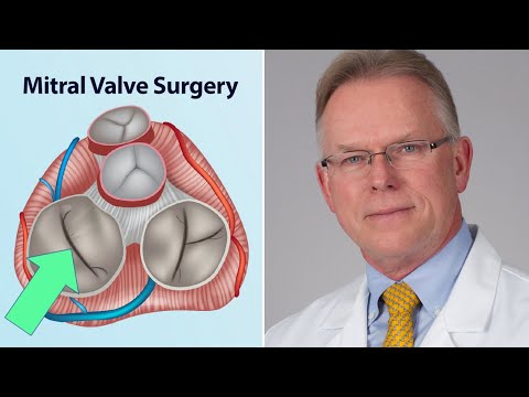Mitral Valve Surgery: What Should Patients Know? (Interview with Dr. Vaughn Starnes)
