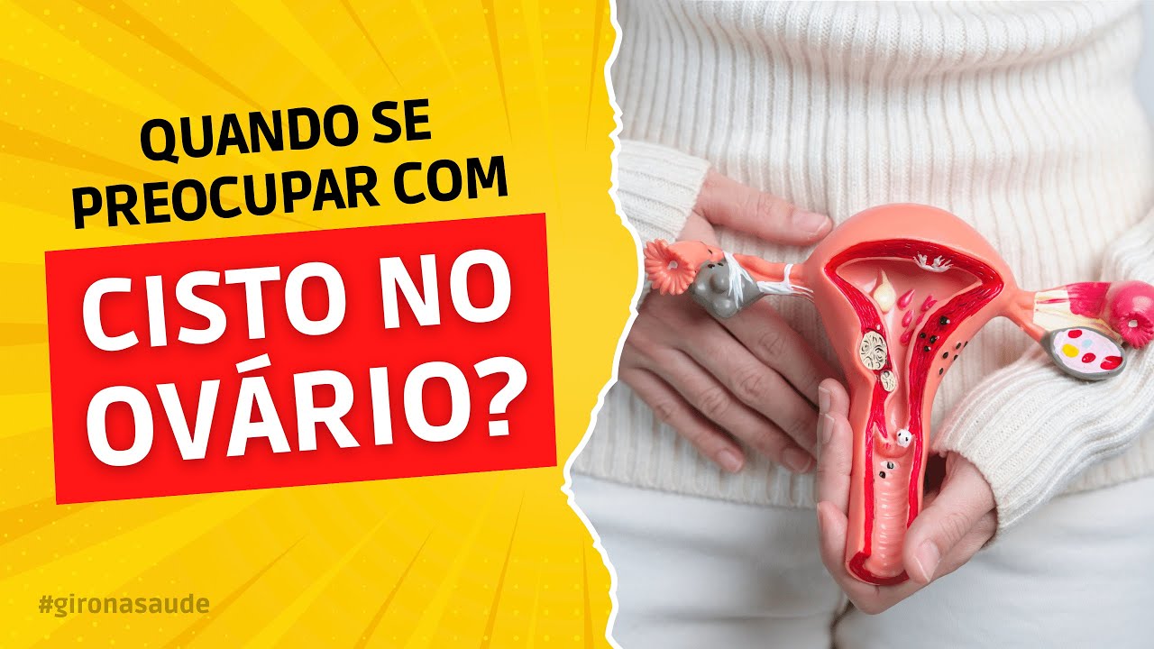 Cisto no Ovário - Causas, Sintomas e Tratamento