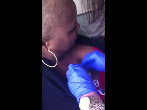 My journey chemotherapy#2.. By puff j.