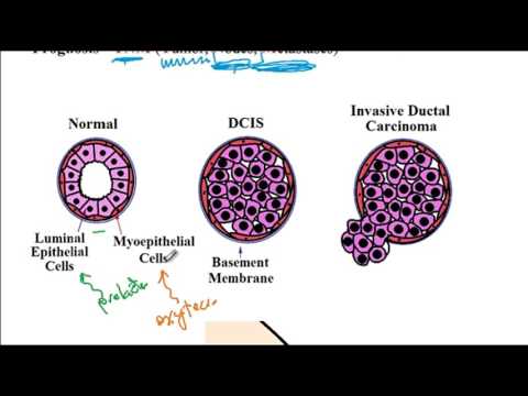 fehér férgek a gyermekszékben intestinal parasite giardia lamblia