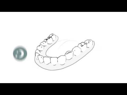 Herausnehmbarer Zahnersatz  - Prothesen richtig reinigen