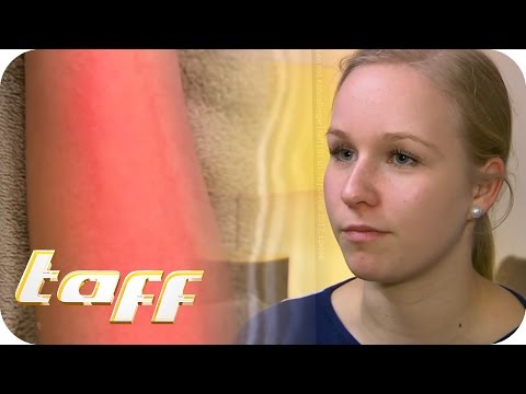 Die Ringelrose bei der Behandlung des Ekzems Die Schuppenflechte die Beschreibung der Effloreszenzen