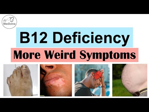 Vitamin B12 Deficiency Weird Symptoms – Part 2 (Types of Headaches, Gastrointestinal and Others)
