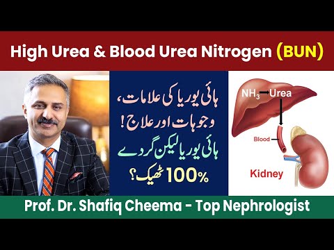 High Urea & Blood Urea Nitrogen (BUN) | Symptoms & Treatment