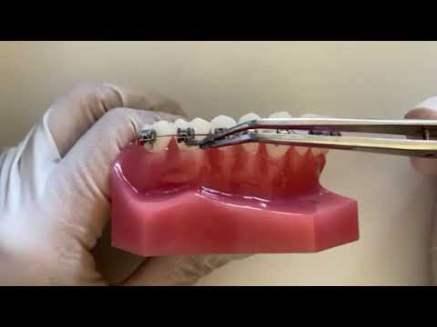 How to remove a power chain if it's causing discomfort