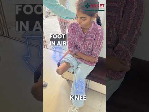 Below Knee Artificial Limb