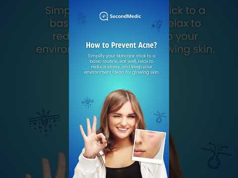 How to Prevent Acne?