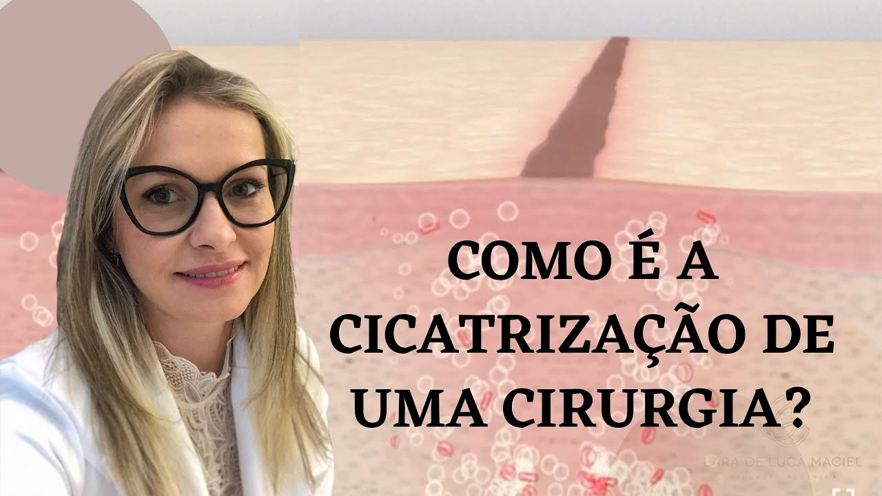 Como é a cicatrização de uma cirurgia