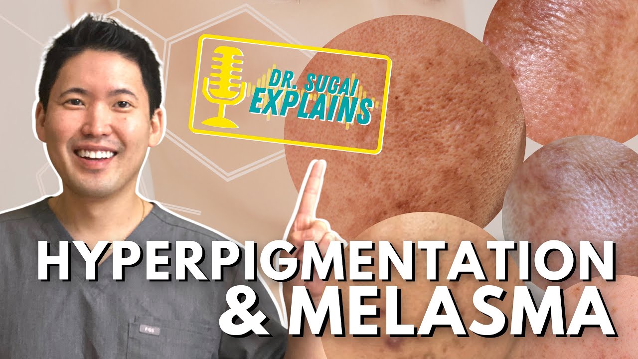 Dermatologist Explains: Hyperpigmentation and Melasma - How to Manage it with Top Picks