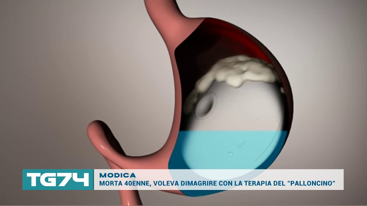 MODICA, MORTA 40ENNE, VOLEVA DIMAGRIRE CON LA TERAPIA DEL PALLONCINO