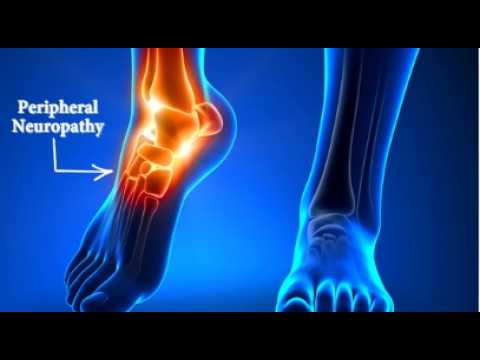 Patient Story Video