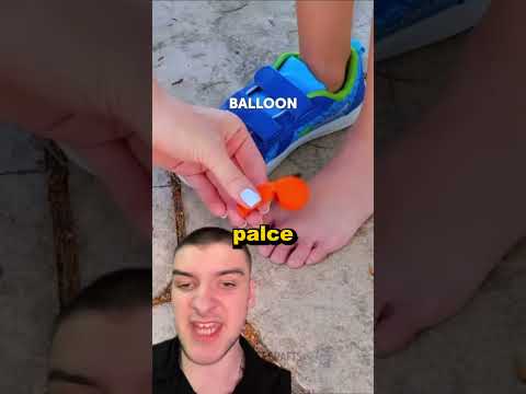 Mam odgnioty na palcach