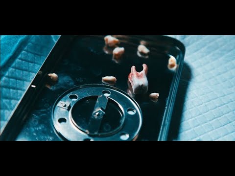 SK Glock Ft. SK Kel - Missing A Tooth | Shot By: @JoeyLenz_