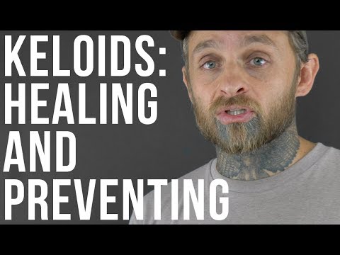 Body Piercings: Keloids / Hypertrophic Scar Tissue | UrbanBodyJewelry.com