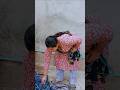 Paip Ki Halat Khrab Viralvideo Viralyoutubevideo Shortvideo Virralshorts