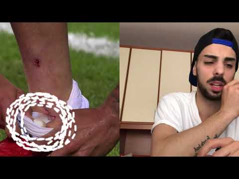 Fisioterapia per il trattamento della malattia degenerativa del disco Cosa fare per alleviare il dolore al collo