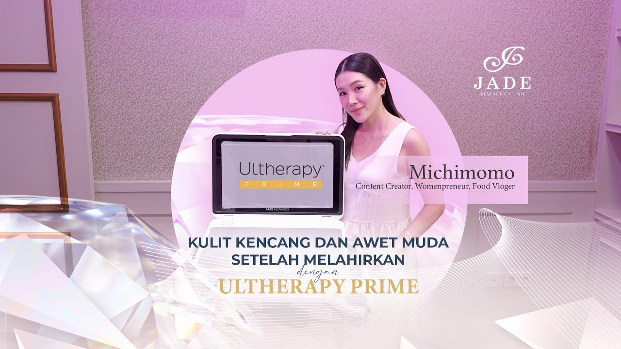 Michimomo | Tampil Awet Muda Setelah Melahirkan dengan #Ultherapy PRIME