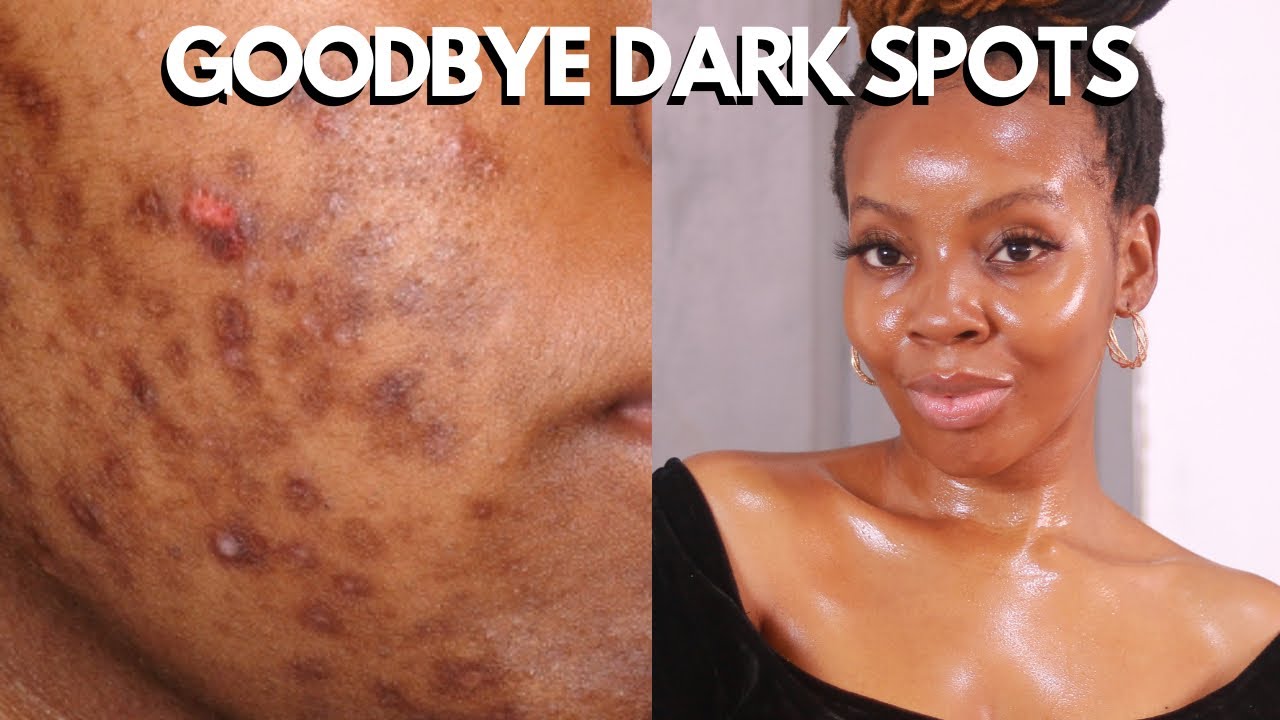 ASCORBIC ACID VITAMIN C | ASCORBIC ACID 8+ALPHA ARBUTIN 2| TRUTH ABOUT THE ORDINARY| bye dark spots