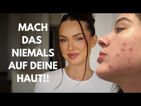 SKIN CARE MISTAKES THAT CAUSE ACNE & PIMPLES *you'll be shocked*