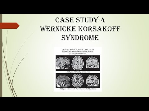CASE STUDY 4-WERNICKE KORSAKOFF SYNDROME(VITAMIN B1 DEFICIENCY)