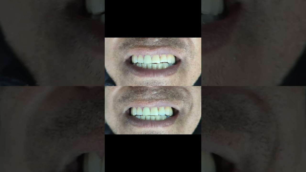 Iván Jael Maldonado Soriano-10