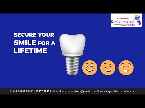 Secure Your Smile For A Lifetime With Dental Implants| Best Dental Implants in Bangalore