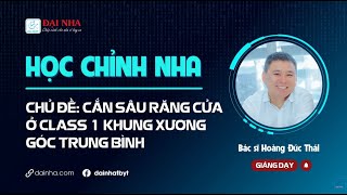 Học chỉnh nha - Cắn sâu răng cửa ở class 1 khung xương góc trung bình. #niengrang #tintuc