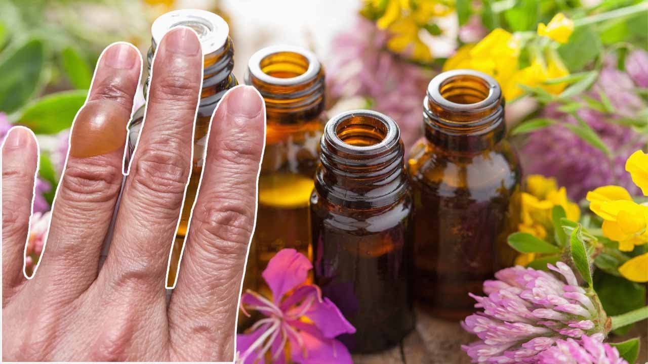 Aceite de hipérico Usos quemaduras, arrugas, Heridas, propiedades y modo de aplicación