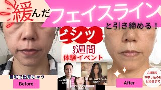 たるんだフェイスラインや老け線と3週間でさよならしちゃう💓体験イベント開催!