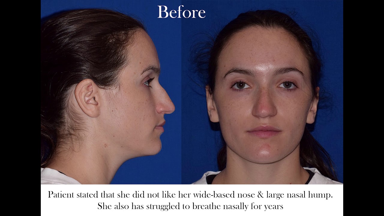 Robb Facial Plastic Surgery