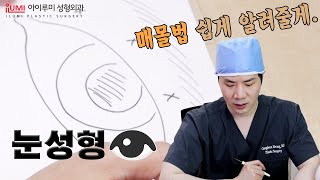 [Dr.허니팁]쌍수고민? #매몰법 짧고 굵게 알려줄게! : 아이루미 허우진원장님