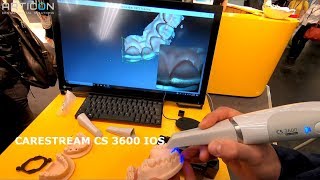 IDS 2019 - Cтенд Carestream: интраоральный сканнер CS 3600