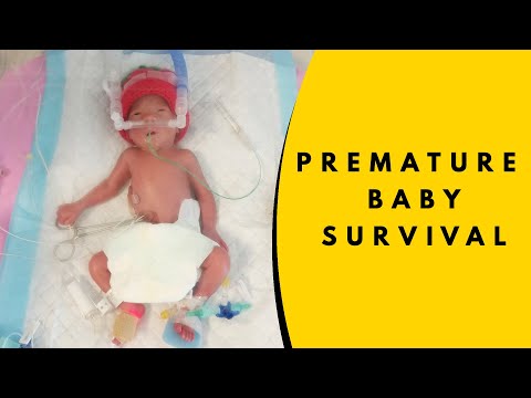 Premature Baby: How Premature Baby Can Survive