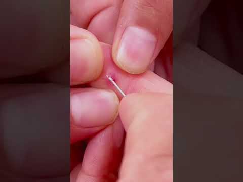 Cain Doctor al rescate. 🫶