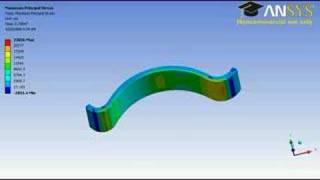 ANSYS Prosthetic foot 2