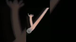 Biology | Budding in hydra | Asexual reproduction | How do organisms reproduce #shorts